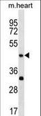 Actin Like 7B antibody, LS-C158165, Lifespan Biosciences, Western Blot image 