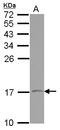 Vesicle Associated Membrane Protein 1 antibody, LS-C155191, Lifespan Biosciences, Western Blot image 