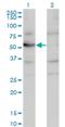 Carnosine Dipeptidase 2 antibody, H00055748-M09, Novus Biologicals, Western Blot image 