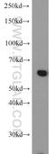 Cystathionine-Beta-Synthase antibody, 14787-1-AP, Proteintech Group, Western Blot image 