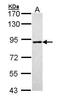 Solute Carrier Family 26 Member 8 antibody, GTX105009, GeneTex, Western Blot image 