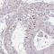 Chromosome 19 Open Reading Frame 54 antibody, NBP2-32485, Novus Biologicals, Immunohistochemistry frozen image 