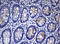 Mucin 16, Cell Surface Associated antibody, LS-C175581, Lifespan Biosciences, Immunohistochemistry frozen image 