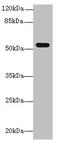 Transmembrane Protein 161A antibody, A61370-100, Epigentek, Western Blot image 