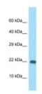 Ribosomal Protein S10 antibody, NBP1-98599, Novus Biologicals, Western Blot image 