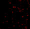 BR Serine/Threonine Kinase 1 antibody, A05997-1, Boster Biological Technology, Immunofluorescence image 