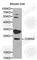 Cyclin Dependent Kinase Inhibitor 3 antibody, A2061, ABclonal Technology, Western Blot image 