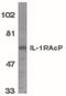 Interleukin 1 Receptor Accessory Protein antibody, PA5-19920, Invitrogen Antibodies, Western Blot image 