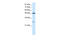 Chloride Intracellular Channel 4 antibody, 28-254, ProSci, Western Blot image 