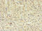 TBC1 Domain Family Member 20 antibody, LS-C378714, Lifespan Biosciences, Immunohistochemistry paraffin image 