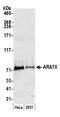 Nuclear Receptor Coactivator 4 antibody, NBP1-28720, Novus Biologicals, Western Blot image 