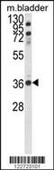 Coiled-Coil Domain Containing 3 antibody, 63-624, ProSci, Western Blot image 