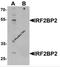 Interferon regulatory factor 2-binding protein 2 antibody, 6705, ProSci Inc, Western Blot image 