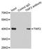 Twinfilin Actin Binding Protein 2 antibody, LS-C334347, Lifespan Biosciences, Immunoprecipitation image 