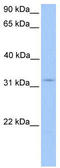 Potassium Channel Tetramerization Domain Containing 21 antibody, TA334960, Origene, Western Blot image 