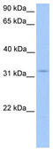 Potassium Channel Tetramerization Domain Containing 21 antibody, TA334960, Origene, Western Blot image 