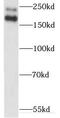 Myosin XVIIIA antibody, FNab05501, FineTest, Western Blot image 