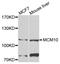 Minichromosome Maintenance 10 Replication Initiation Factor antibody, LS-C346276, Lifespan Biosciences, Western Blot image 