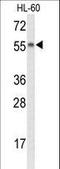 Nyctalopin antibody, LS-C163091, Lifespan Biosciences, Western Blot image 