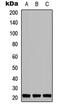 TNF Alpha Induced Protein 8 Like 1 antibody, MBS8207932, MyBioSource, Western Blot image 