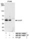 ILK Associated Serine/Threonine Phosphatase antibody, NB100-74606, Novus Biologicals, Western Blot image 