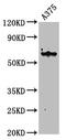 Keratin 6A antibody, CSB-PA012561EA01HU, Cusabio, Western Blot image 