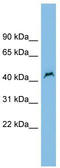 Patatin Like Phospholipase Domain Containing 1 antibody, TA330996, Origene, Western Blot image 