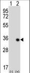 Serine/Threonine Kinase 16 antibody, LS-C100780, Lifespan Biosciences, Western Blot image 