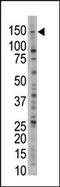 Ubiquitin Specific Peptidase 28 antibody, 61-114, ProSci, Western Blot image 