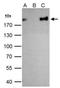 Zinc Finger E-Box Binding Homeobox 1 antibody, GTX105278, GeneTex, Immunoprecipitation image 