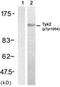 Tyrosine Kinase 2 antibody, TA309989, Origene, Western Blot image 