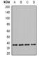 Pyruvate Dehydrogenase E1 Beta Subunit antibody, abx142133, Abbexa, Western Blot image 