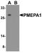 Transmembrane prostate androgen-induced protein antibody, A05994-1, Boster Biological Technology, Western Blot image 