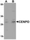 Centromere Protein O antibody, A11021, Boster Biological Technology, Western Blot image 