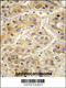 PTPN1 antibody, LS-C100983, Lifespan Biosciences, Immunohistochemistry paraffin image 