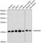 Mago Homolog, Exon Junction Complex Subunit antibody, GTX64825, GeneTex, Western Blot image 