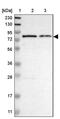 Myotubularin 1 antibody, PA5-52682, Invitrogen Antibodies, Western Blot image 