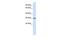 Vesicle Transport Through Interaction With T-SNAREs 1A antibody, GTX45696, GeneTex, Western Blot image 