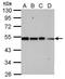 COP9 Signalosome Subunit 2 antibody, GTX116463, GeneTex, Western Blot image 