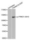 Protein Kinase D1 antibody, abx000211, Abbexa, Western Blot image 