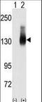 Jagged Canonical Notch Ligand 2 antibody, LS-C100395, Lifespan Biosciences, Western Blot image 