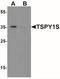 Testis Specific Protein Y-Linked 1 antibody, NBP2-41199, Novus Biologicals, Western Blot image 