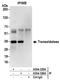Transaldolase 1 antibody, A304-325A, Bethyl Labs, Immunoprecipitation image 