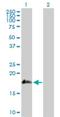 SSH-2L antibody, H00085464-D01P, Novus Biologicals, Western Blot image 