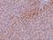 TBK1 Binding Protein 1 antibody, GTX85248, GeneTex, Immunohistochemistry paraffin image 