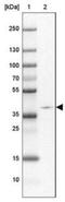 Protein ZNF365 antibody, NBP2-30451, Novus Biologicals, Western Blot image 