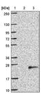 Transmembrane Protein 97 antibody, NBP1-92522, Novus Biologicals, Western Blot image 