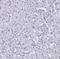 PRP antibody, NBP1-92285, Novus Biologicals, Immunohistochemistry paraffin image 