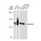 Janus Kinase 2 antibody, GTX01195, GeneTex, Western Blot image 