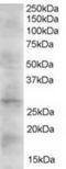 Dickkopf WNT Signaling Pathway Inhibitor 2 antibody, TA302770, Origene, Western Blot image 
